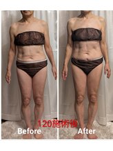 フィニシオン/70代120分施術　ゴルファー