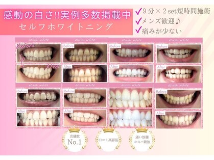 セルフホワイトニングサロン エクシアホワイトニング 自由が丘店の写真