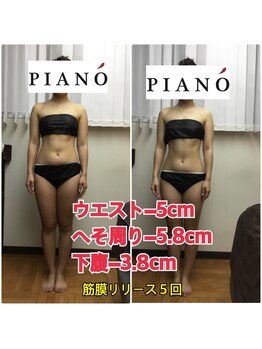 ピアーノ(PIANO)/筋膜リリース