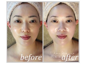 アン グレーヌ 自由が丘(unegraine)/ツヤツヤピカピカ！ハツラツ美人