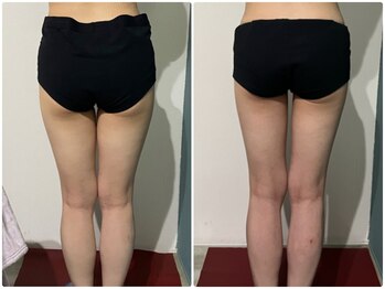 OBS/下半身集中痩身