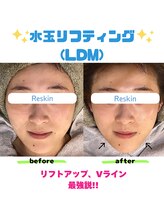 リスキン(Reskin)/《話題の韓国美容》