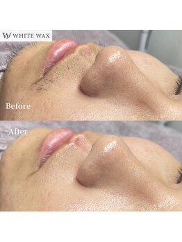 ホワイトワックス 浜松(WHITE WAX)/美肌男子、急増中！