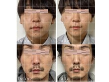 小顔整体 優の雰囲気（女性はもちろん、男性も小顔になれちゃいます☆）