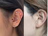 【スッキリで映え♪】耳つぼジュエリー＆もみあげWax脱毛　6500円→5700円
