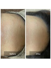 リノリー(rinory)/グレーズソフトピール