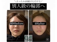 キュープ 練馬店(Qpu)の雰囲気（1対1で、丁寧に小顔頭蓋骨矯正をいたします。）
