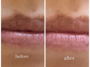 ジジベレッザ 芦屋店(jiji belleza)/LEMELLA/ルメラ色という選択