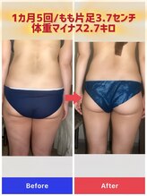 カルミア 心斎橋店/30代お客様/ゼロコース