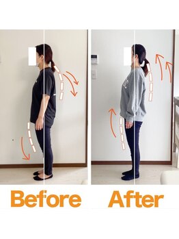 整体院ひなた 都城院/産後整体で肩こり腰痛骨盤-6cm!!