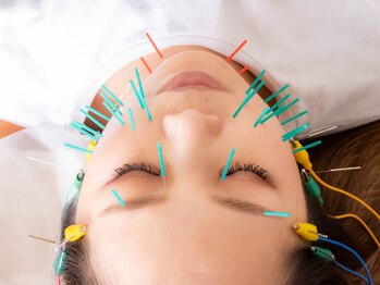 スタイル鍼灸整骨院/美容鍼！