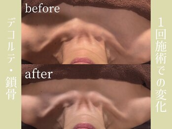 健志接骨院/πテラピー造顔メソッド　