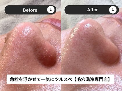 クリアホワイト(Clear White)の写真