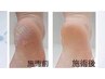 【フットオフ込み角質ケア付き♪】ＦＯＯＴ２本アート12100円→9900円！