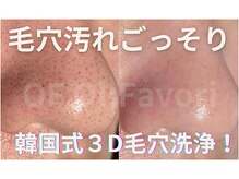 オフオルファヴォリ(OF Olu:Favori)