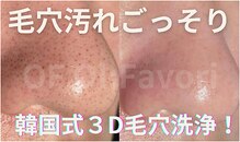 オフオルファヴォリ(OF Olu:Favori)