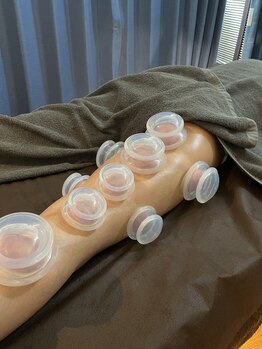 タオ(TAO)/置きカッピングも併用