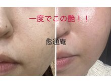 パーフェクトボディ(PERFECT BODY)/ポテンツァであなたも韓国美人に