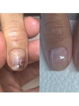 ウェルズユキ(well's yuki)/自爪育成（爪が厚くなる）