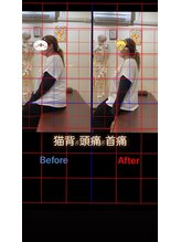 ヒデ整体院(Hide整体院)/猫背矯正骨盤矯正B/A肩こり腰痛