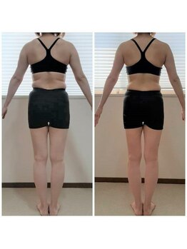 ウィルビーアシヤ(Will be ASHIYA)/モニター様1-後ろ/40代