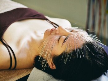 鍼処シラカワ なごや院千種(鍼処SHIRAKAWA)/