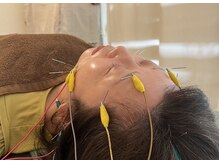 久心宝鍼灸院/通電美容鍼