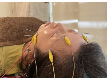 久心宝鍼灸院/通電美容鍼