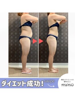 ミノ 美里大通り店(mino)/ダイエットパッケージプラン