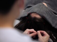 鍼灸院 HARe’s【12月8日NEW OPEN(予定)】