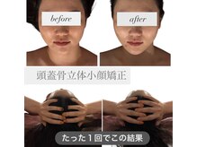 スカイ(sky)の雰囲気（埼玉県に３台しかない！世界初のマシン☆痛み少ない揉み返しなし）