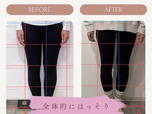 アンダーセブン(Under Seven)/お客様の変化★美脚/足引き締め