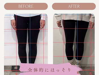 アンダーセブン(Under Seven)/お客様の変化★美脚/足引き締め