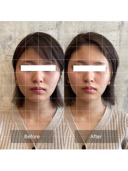 フフラ KANコルギセラピー山梨本店(fufla)/小顔ソムリエ【小顔　頭蓋骨】