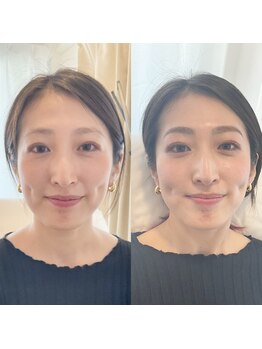 カフー 自由が丘(KAFU jiyugaoka)/アイブロウ眉毛WAXで激変