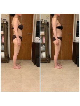 ブランシェ 銀座(blanche)/気になるお腹もすっきり