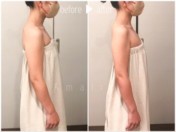 アマリエ/ブライダルコース