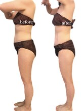 リリィブラン(Lily branc)/痩身/お腹＋腰痩せ/中半身痩身