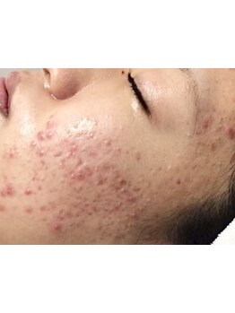 お肌をきれいにしたい