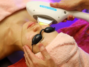 CBDサロン ローズ(ROSE)の写真/＜思わず触りたくなる陶器肌へ＞肌荒れ跡やニキビケアに/光フェイシャルで透けるような結果重視の施術◎