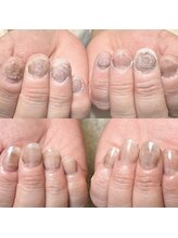 ハッカネイル(HAKKA NAIL)/