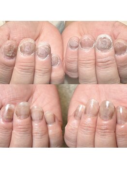 ハッカネイル(HAKKA NAIL)/