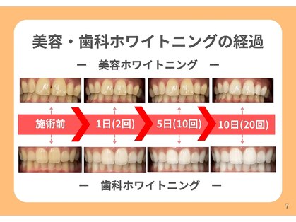 ホワイトニングセンター 大阪羽曳野店の写真