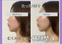 ルリアン(Lurian)