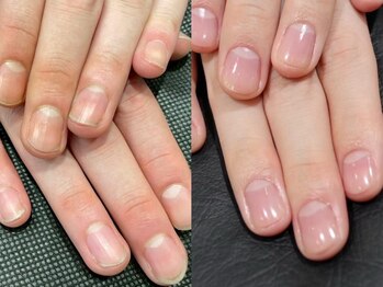 ディーディー(DxD)/ネイルケア