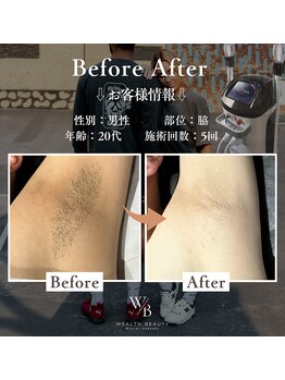 ウェルスフィットネス 南福岡(Wealthfitness)/before after写真公開!!