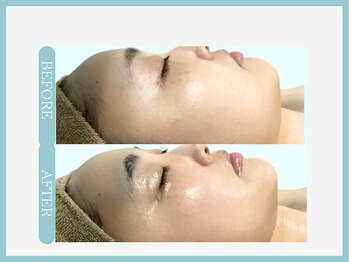 スリムライン 青森店(The Slim Line)/before→after