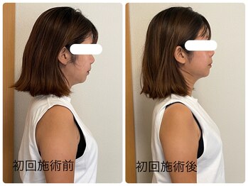 キッカ(kikka)/姿勢改善で横顔すっきり◎