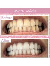 エクシアホワイト 平岸駅前店/