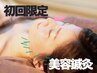 【美容鍼】クイック美容鍼40分☆肌質改善or小顔★仕事帰り・休憩中に!¥3520